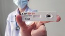 Prefeitura comprará 12 mil testes rápidos para a Covid19 Prefeitura comprará 12 mil testes rápidos para a Covid19